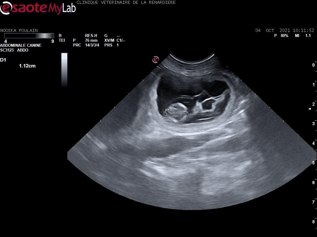 Echographie à 33 jours